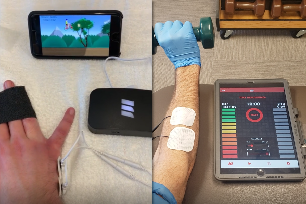 sEMG biofeedback of the hand and forearm with mobile app display