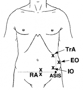 Core motor points