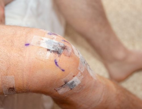 ACL Protocol