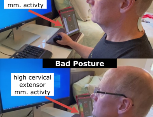 Improving Posture and Neck Pain in Desk Workers with mTrigger Biofeedback